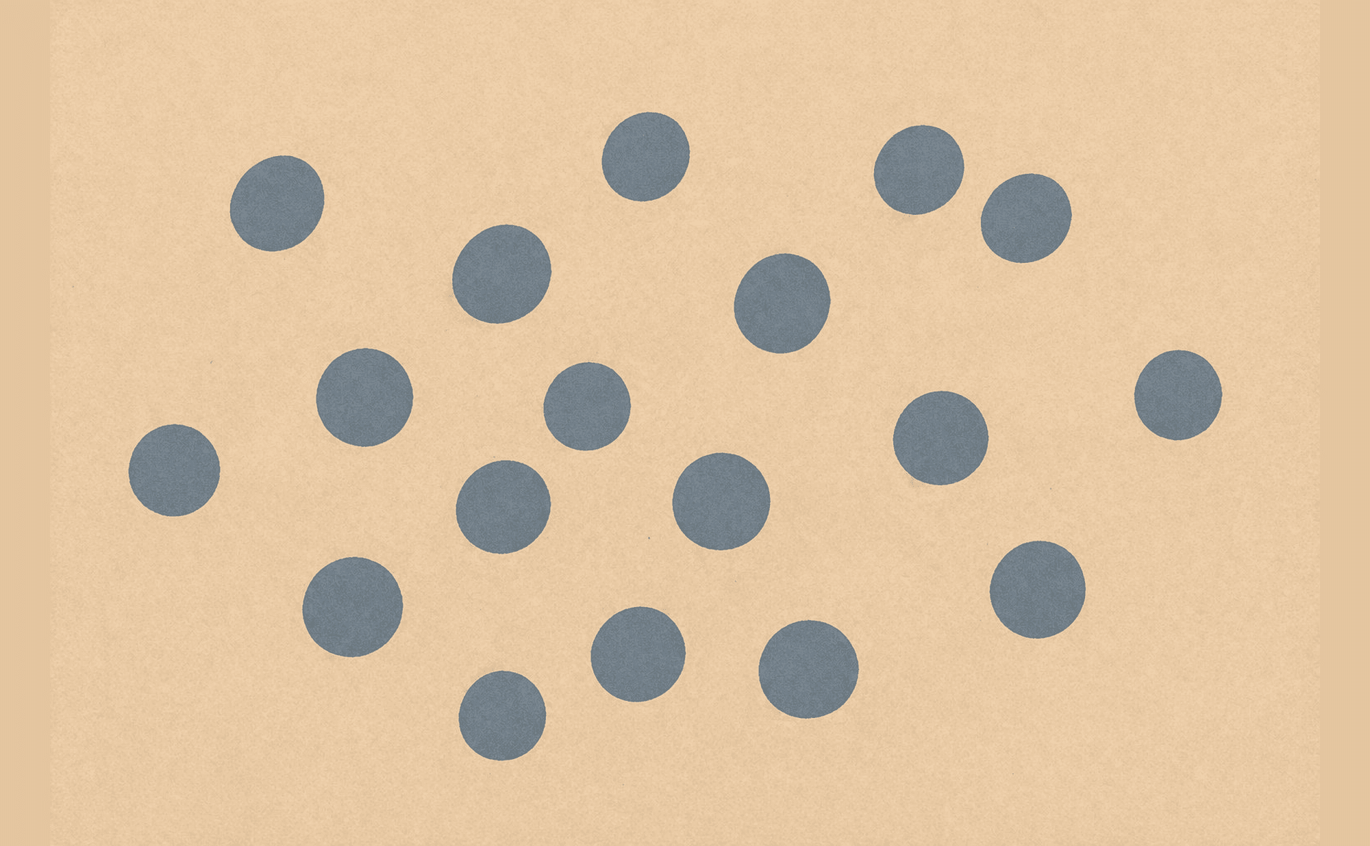 Dermoscopic illustration showing well-defined round grey-blue globules of intermediate size, scattered within a lesion