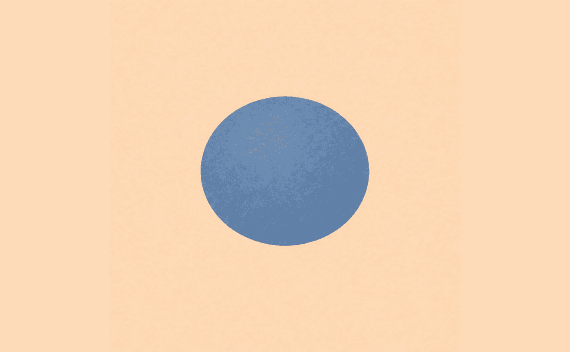 Dermoscopic illustration showing a homogeneous steel-blue structureless lesion with well-demarcated borders