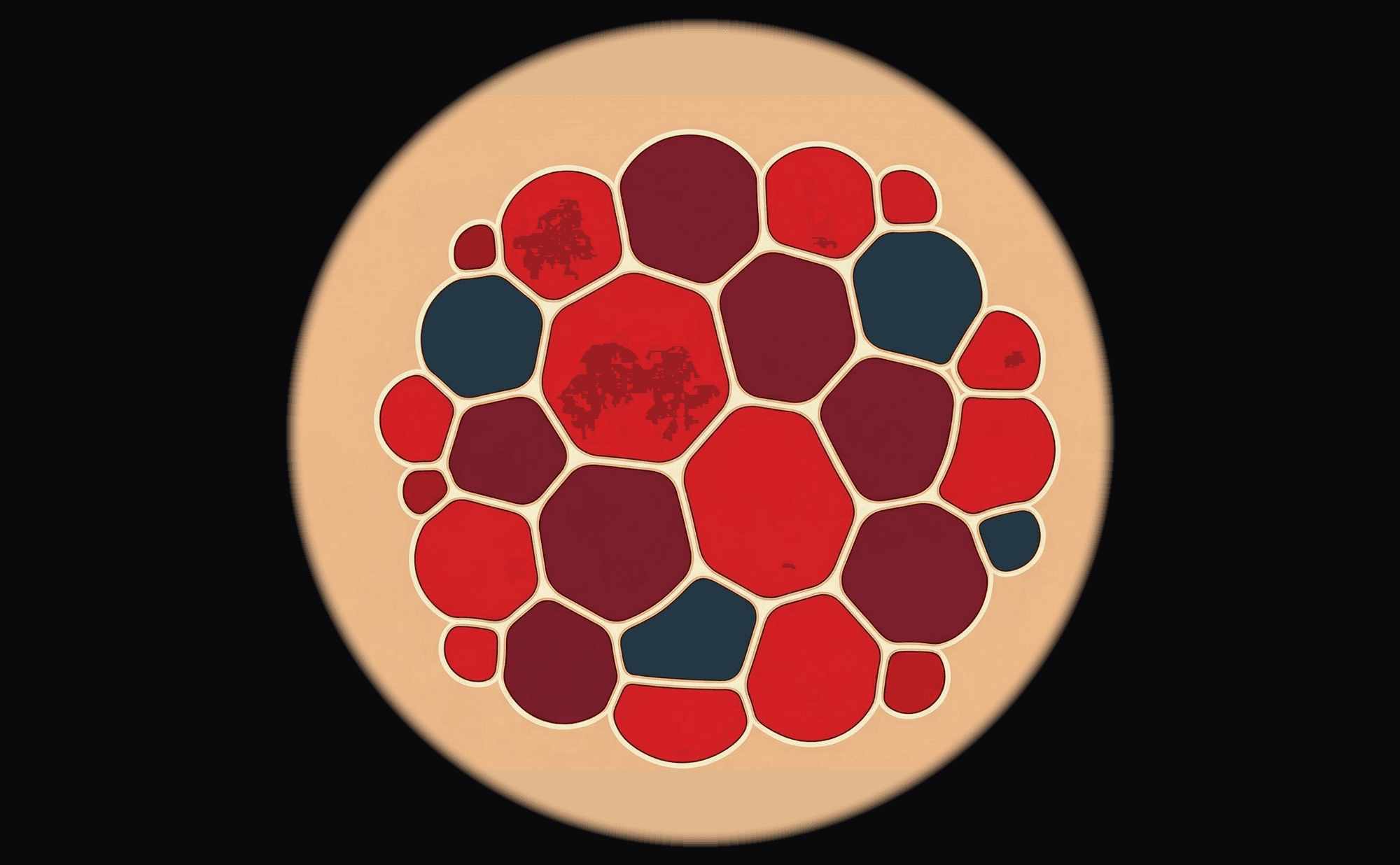 Dermoscopic illustration showing well-defined red-purple lacunae (round vascular compartments) separated by pale septa