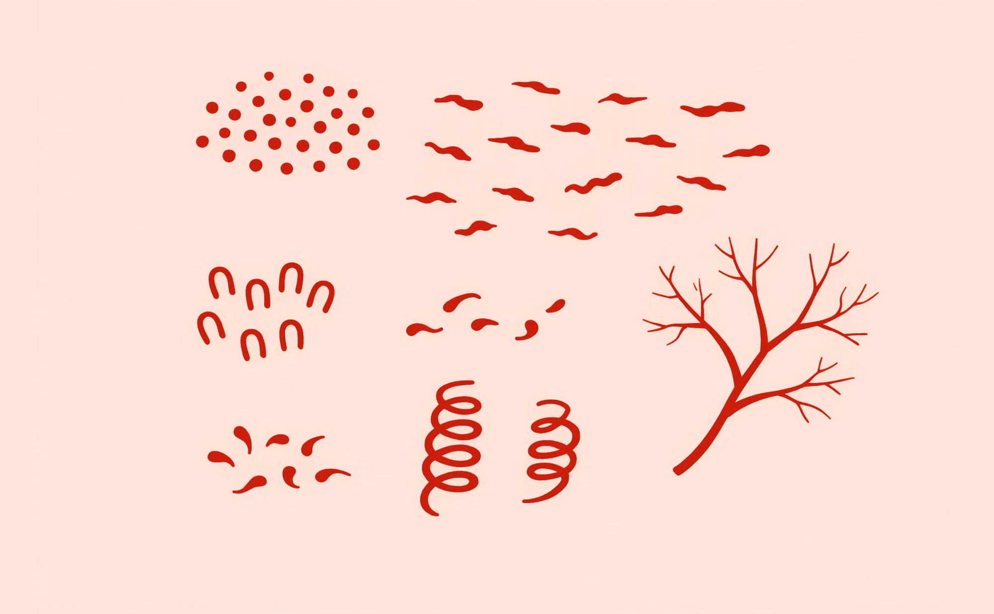 Dermoscopic illustration showing multiple different vessel types coexisting within one lesion — dotted, linear-irregular, and serpentine vessels in chaotic distribution