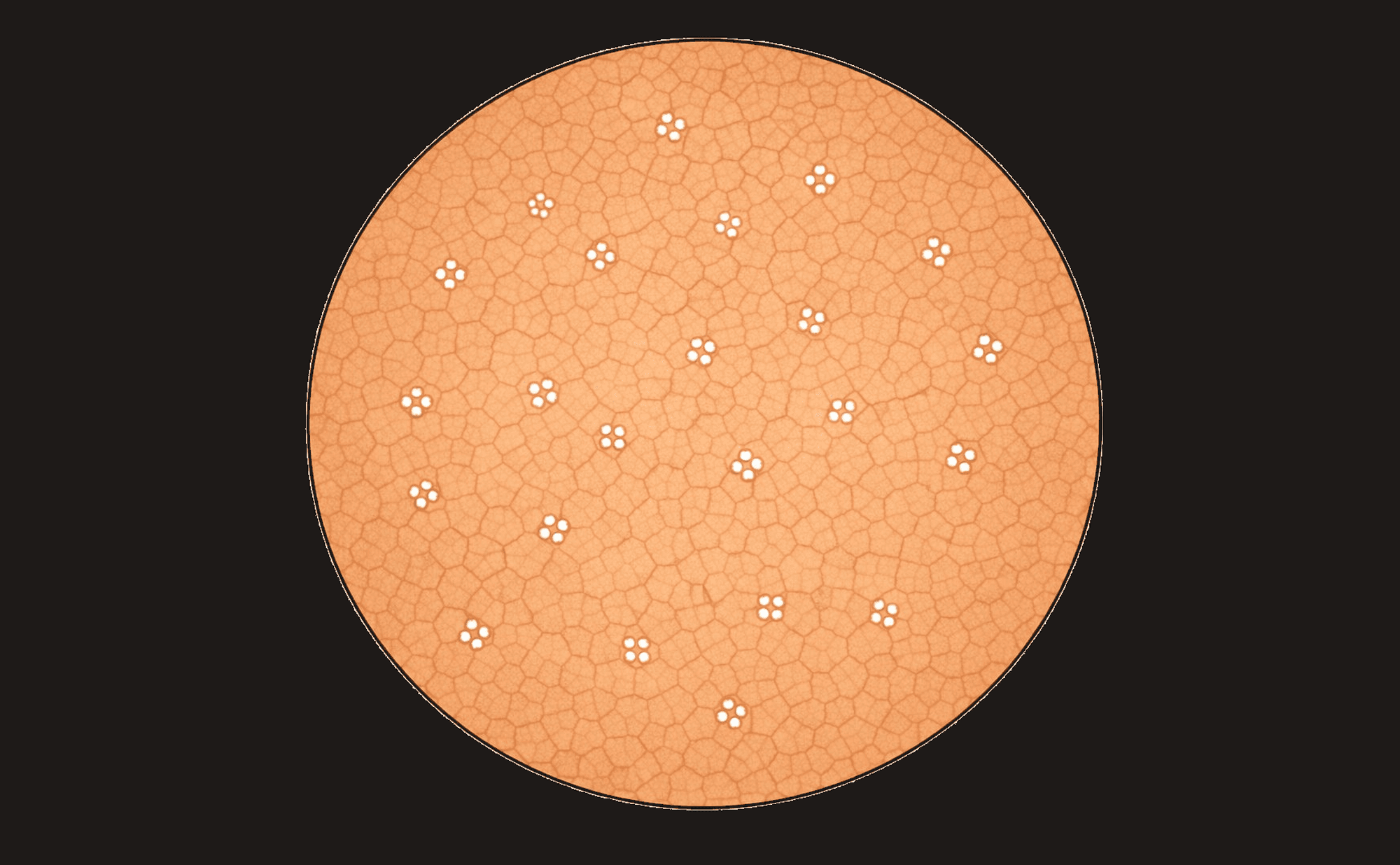 Dermoscopic illustration showing small four-dot clover-leaf rosette structures visible under polarised light