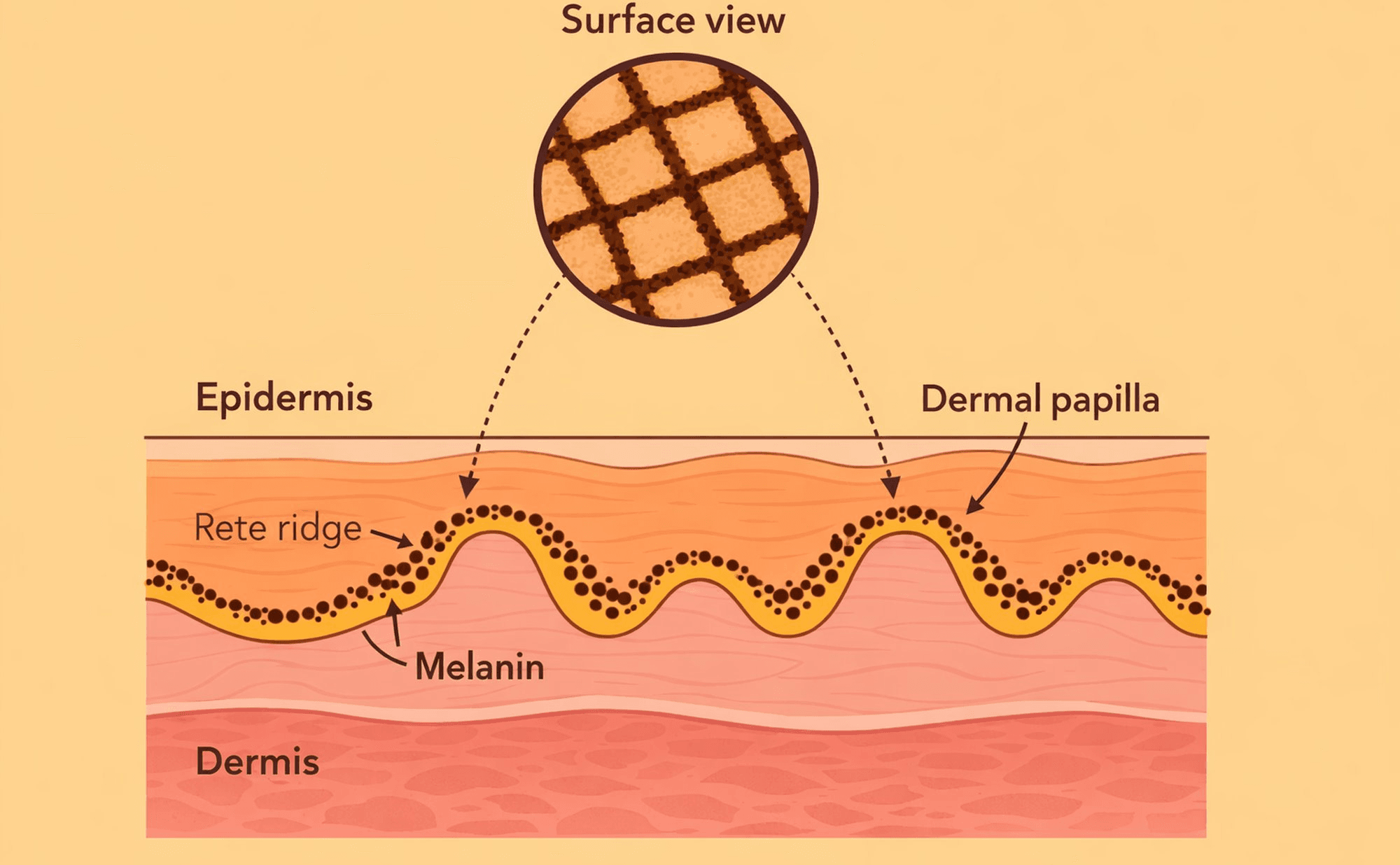 Cross-section and surface view showing how rete ridges project downward from the epidermis, creating the honeycomb pigment network pattern when viewed from above through a dermatoscope.
