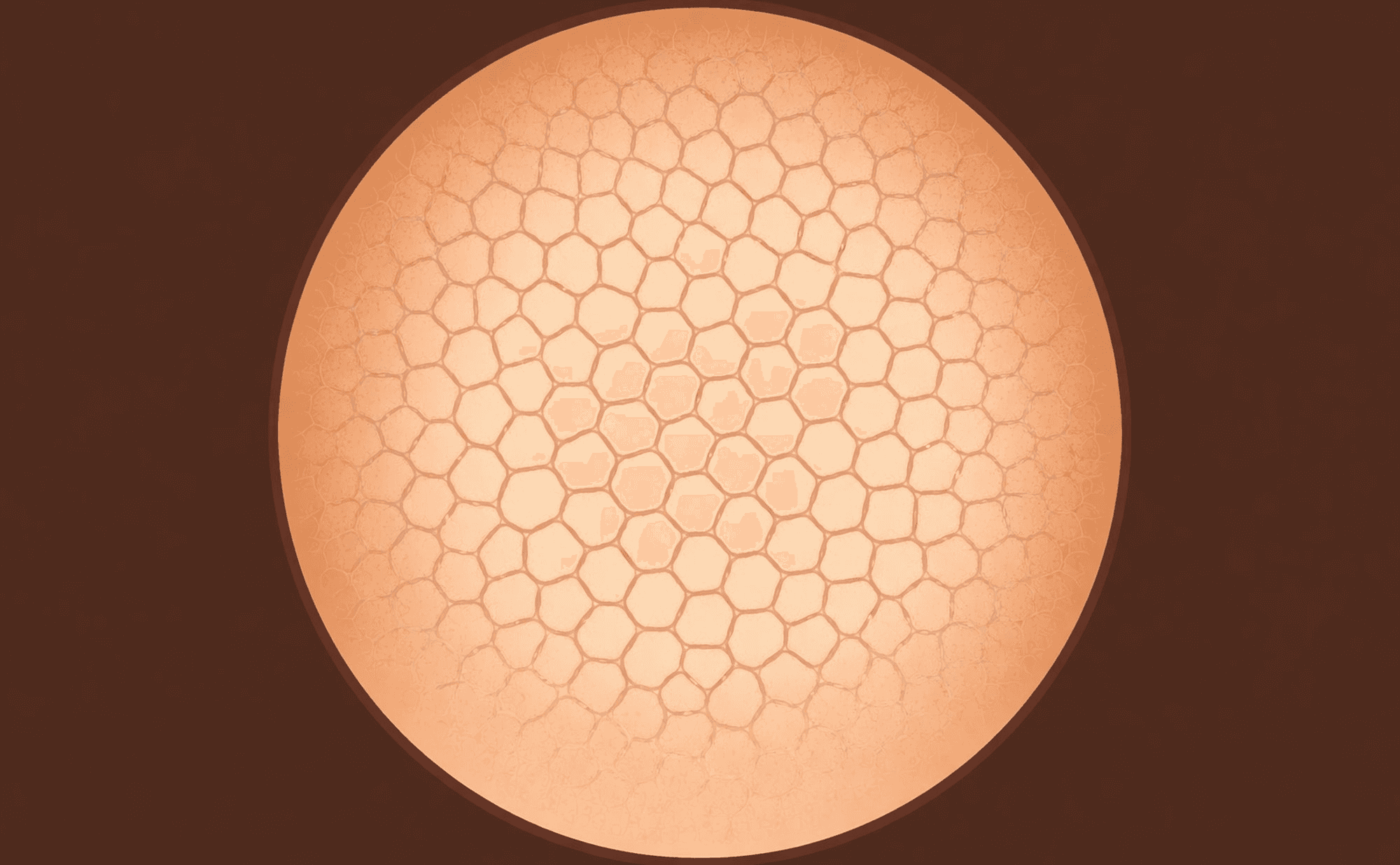 Dermoscopic view showing a typical pigment network with regular spacing, uniform line thickness, and gradual fading at the periphery.