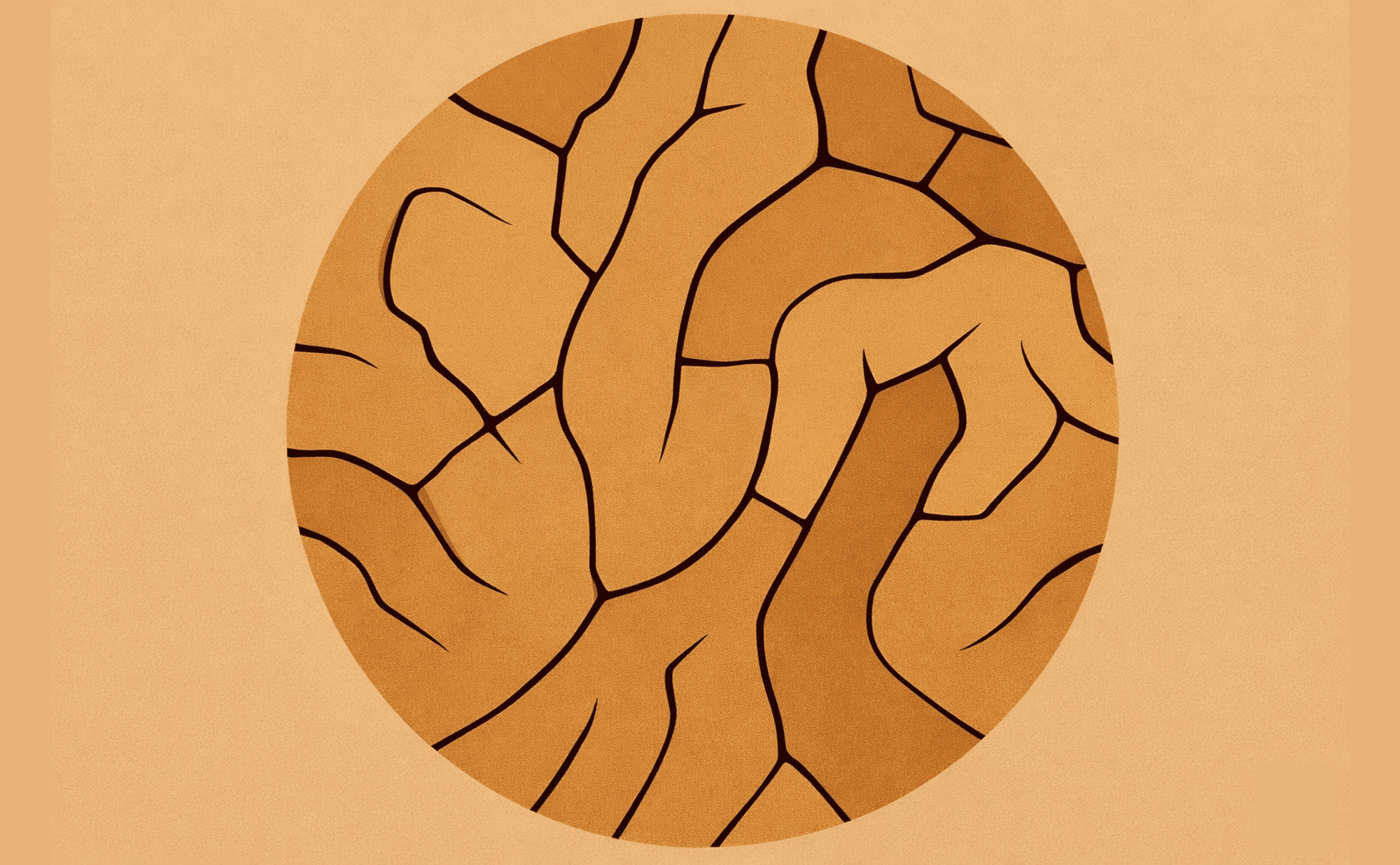Dermoscopic illustration showing cerebriform brain-like surface texture with linear fissures between raised ridges
