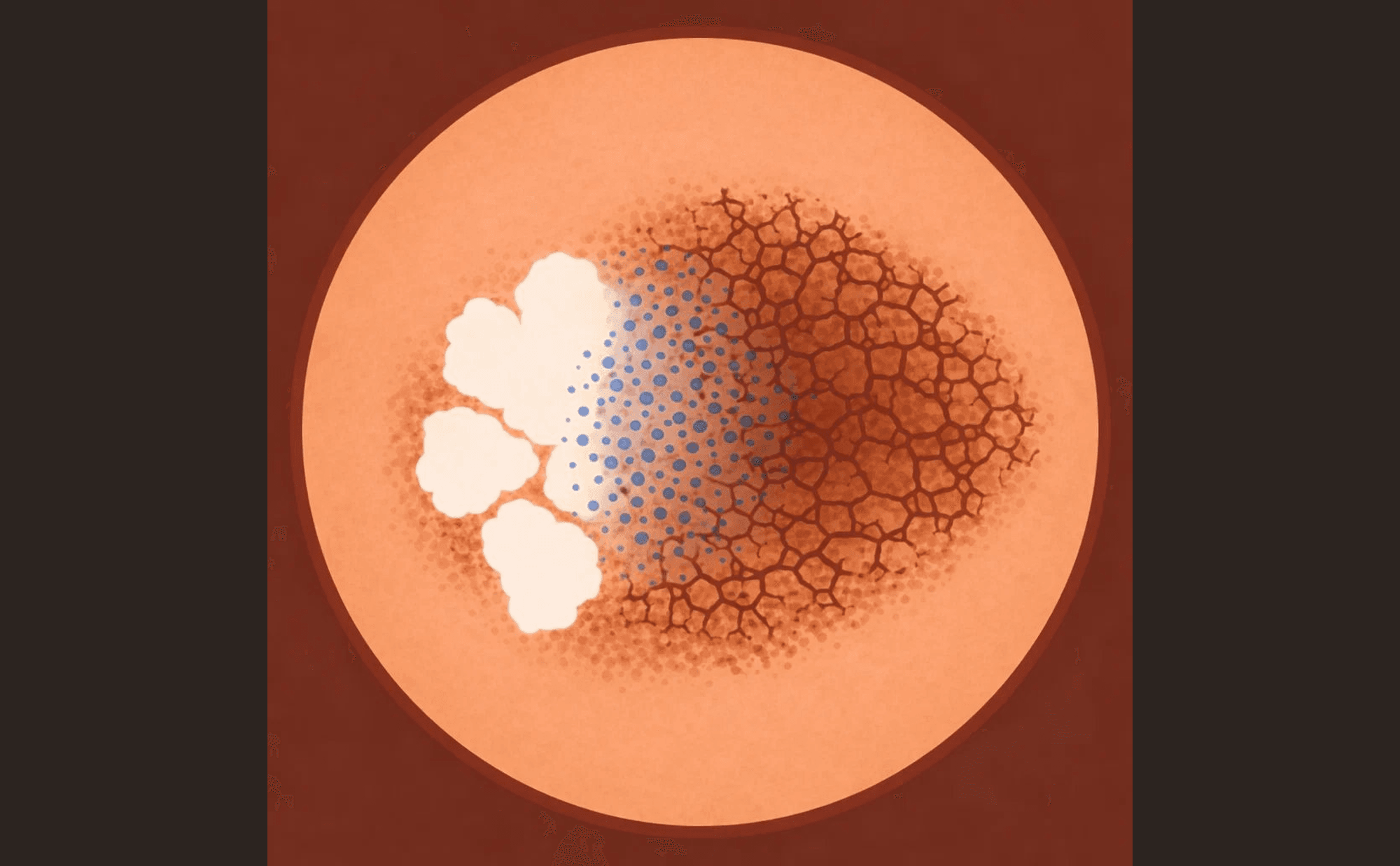 Dermoscopic illustration showing regression structures: white scar-like depigmented patches on the left, scattered blue-grey peppering granules in the centre, and disrupted residual pigment network on the right, demonstrating the progressive destruction of a melanocytic lesion.