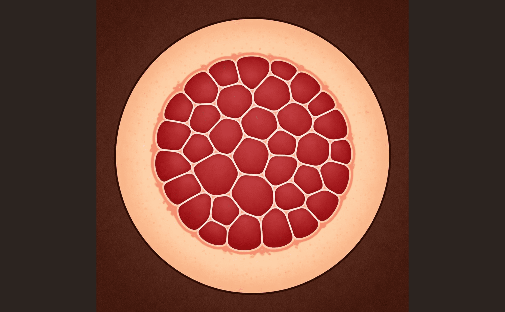 Dermoscopic illustration of classic cherry angioma showing tightly packed red-purple lacunae separated by pale pink septa in a mosaic pattern