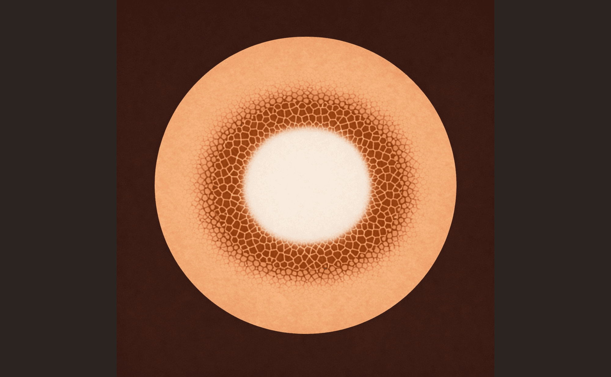 Dermoscopic illustration of classic dermatofibroma showing central white scar-like patch surrounded by delicate peripheral pigment network fading at edges